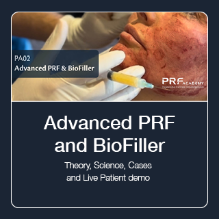 PA02: Advanced PRF and Bio-Filler (19.9)