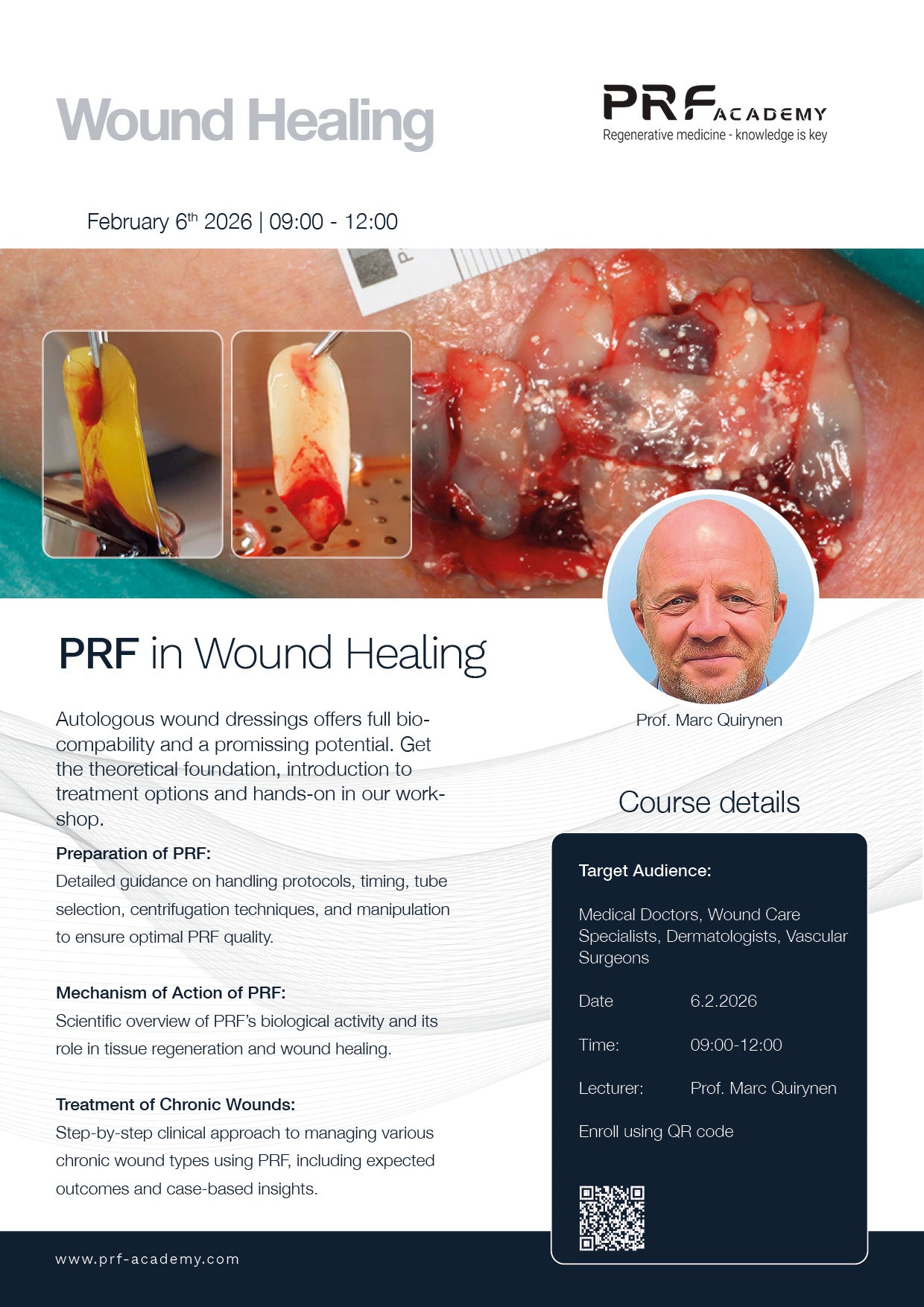 PA08: PRF in Wound Healing (6/2-2026)