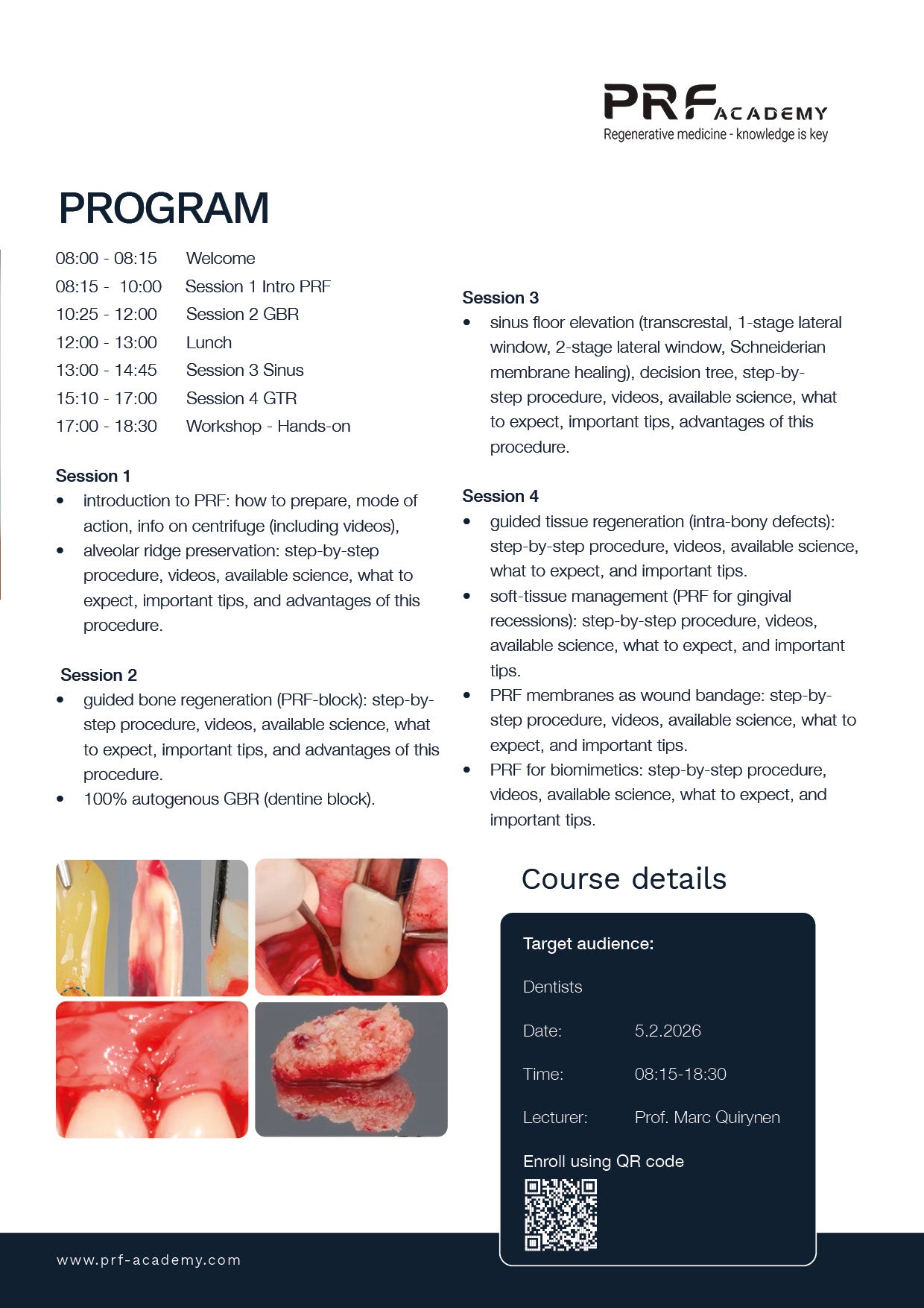 PA07: PRF in Dentistry - full day lecture 5/2-2026